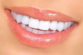 فرق لمینت سرامیکی و کامپوزیتی چیست؟