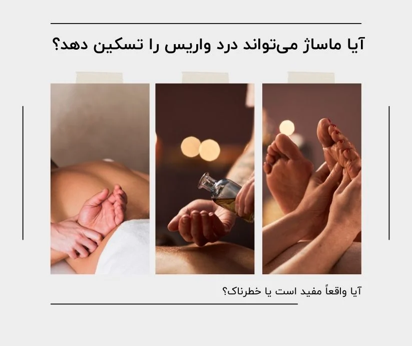 آیا ماساژ برای واریس خوبه؟