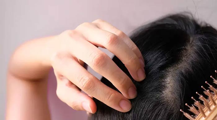 راه‌های خانگی و دارویی برای رویش مجدد مو؛ تجربیات اثبات‌ شده برای مقابله با ریزش مو